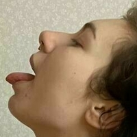 acidmelanie Nahé