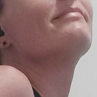 adorablegains Nahé