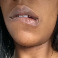 Blkbeautywild Nahé