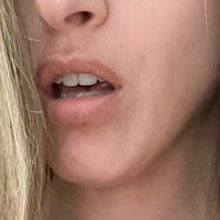 emma-skyeefree Nahé