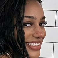 Freckles Nahé
