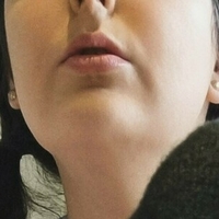 frillymillyx Nahé