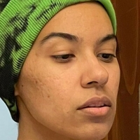 honeyvulture Nahé