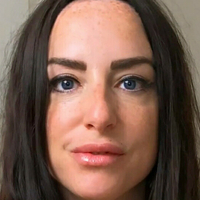 scarred4life3 Nahé