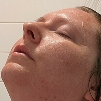 titlaser Nahé