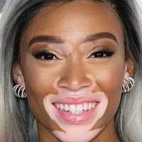 Winnie Harlow Nahé