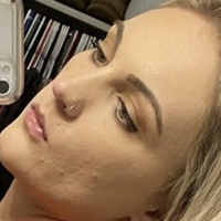 xoxalexis Nahé